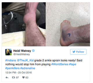 Illustration for article titled Dude, Jason Kipnis, Are You Sure You Can Play On Your Sprained Ankle?